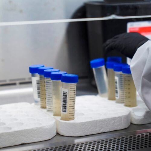 Unveiling the Veil: The Intricacies of Tracking Cannabis Use Through Wastewater